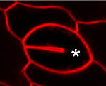 buňka s nedokončenou buněčnou stěnou - následek narušené funkce bílkovinného komplexu exocyst
