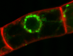  Umístění "popelářské" bílkoviny PIN5 (zeleně) v buňkách tabáku. Snímek Petr Skůpa.